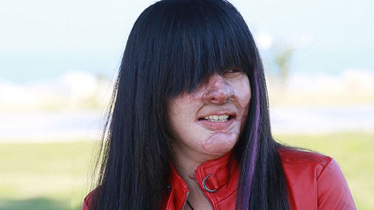 El rostro de la víctima de violencia de género tras ser atacada. El rostro de la víctima de violencia de género tras ser atacada.