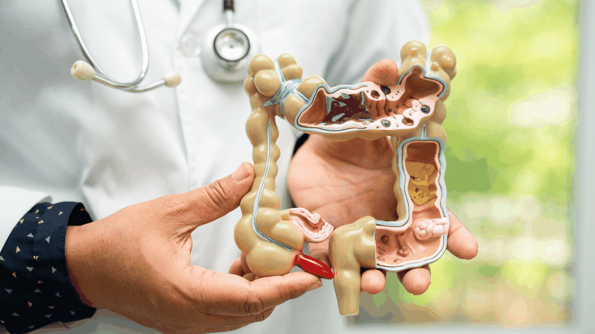 Si cuidas de tu intestino tendrás una vida saludable. Si cuidas de tu intestino tendrás una vida saludable.