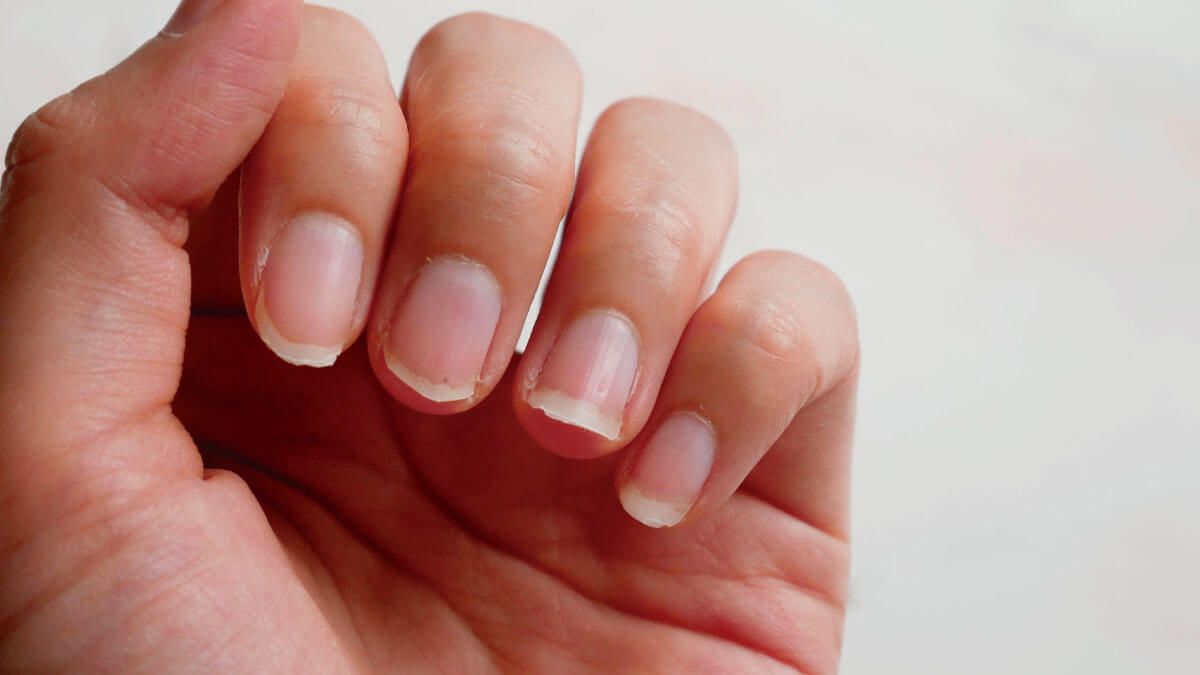 La sencilla mezcla natural de dos ingredientes que fortalecerá tus uñas como nunca antes La sencilla mezcla natural de dos ingredientes que fortalecerá tus uñas como nunca antes