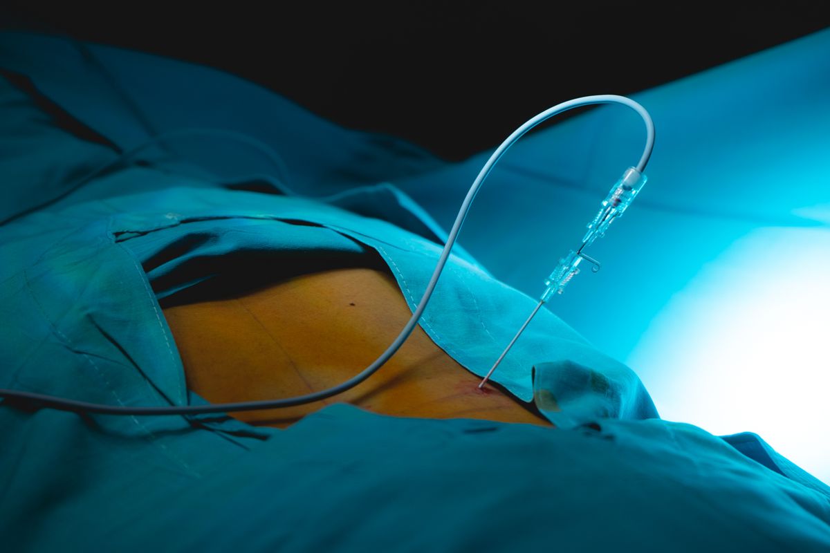 MISS, t & eacute;  cnicas que llegaron para quedarse.