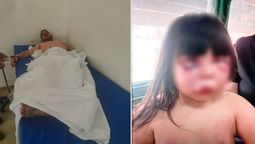 Brutal. Un hombre de 37 le dio una salvaje golpiza a una nena de 7 años hija de su pareja.Foto: clarin.com Brutal. Un hombre de 37 le dio una salvaje golpiza a una nena de 7 años hija de su pareja.Foto: clarin.com