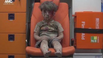 La imagen de un niño herido refleja el drama en la ciudad siria de Alepo