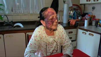 Una jubilada sufrió una brutal golpiza para ser asaltada