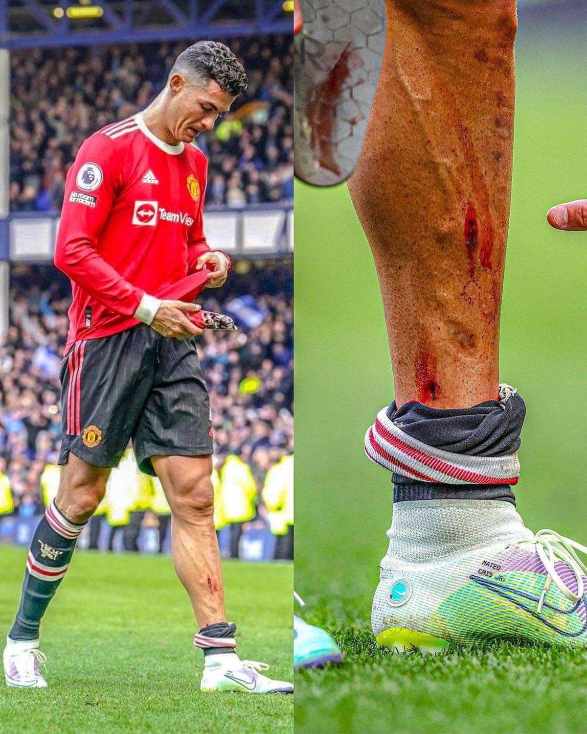 Así terminó Cristiano Ronaldo la derrota del Manchester United ante el Everton