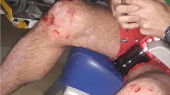 Brutal agresión homofóbica: un hombre atacó una pareja a latigazos