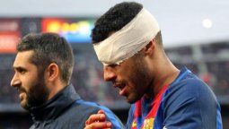 No apto para impresionables: la profunda herida en la cabeza de Rafinha