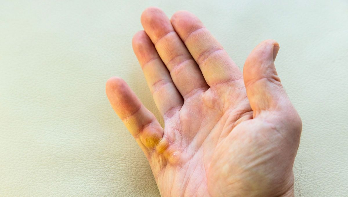 Qué significa tener el dedo del medio de la mano más largo que los demás