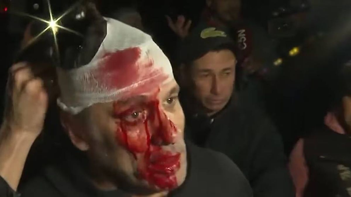 Cristian Mercatante sufrió heridas en la cara y en la cabeza