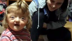 Una guardería le negó el ingreso a una niña por la forma de su cabeza