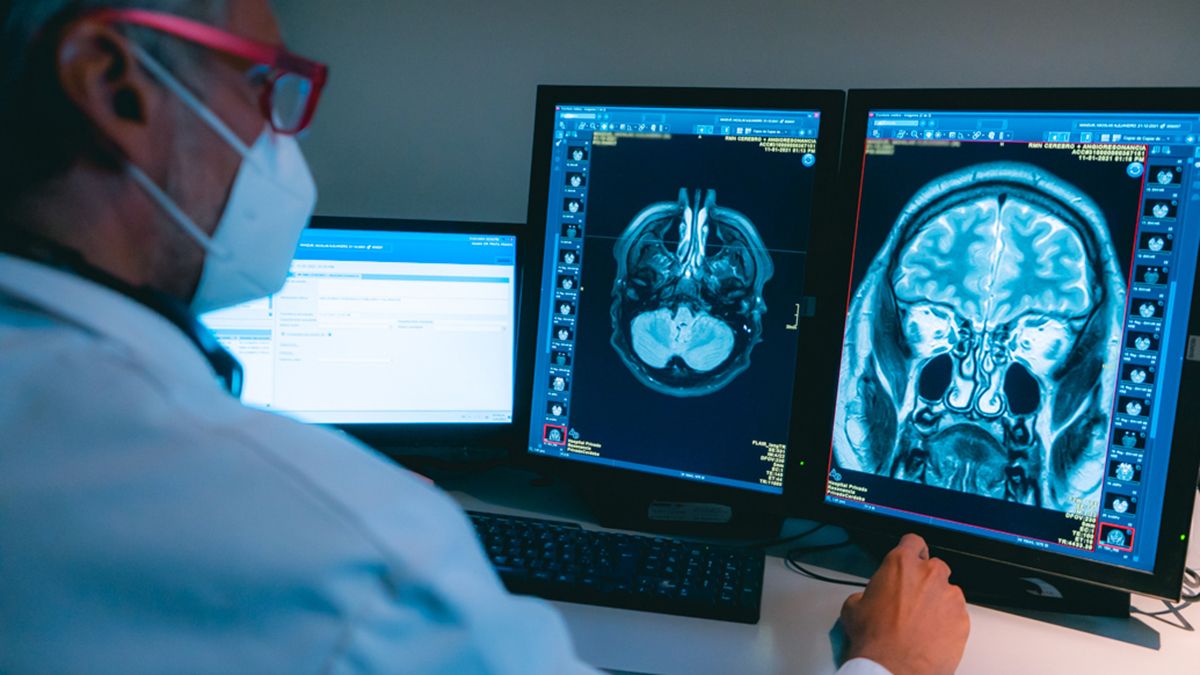 Doctor Federico Roca y estudios de diagnóstico por imágenes para patologías hipofisiarias. 