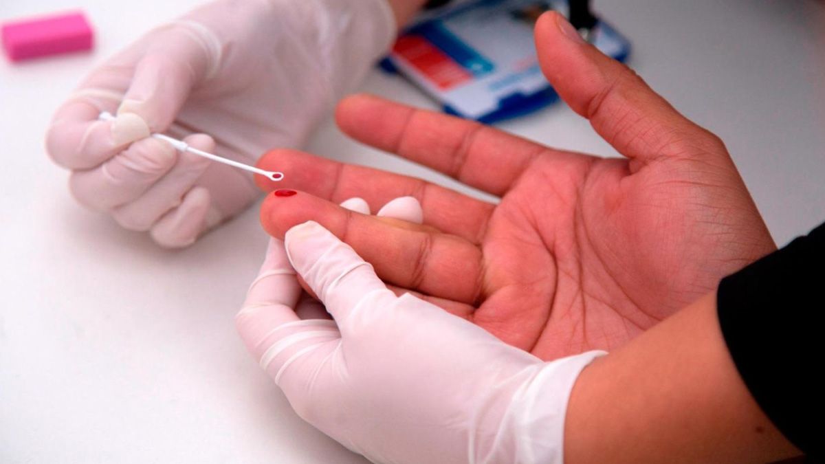 Con solo una gota de sangre se puede determinar el diagnóstico de una persona y saber si tiene el virus del Sida Con solo una gota de sangre se puede determinar el diagnóstico de una persona y saber si tiene el virus del Sida