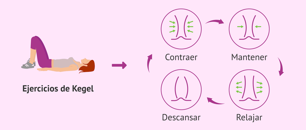 Ejercicios de Kegel, una alternativa a los medicamentos Ejercicios de Kegel, una alternativa a los medicamentos