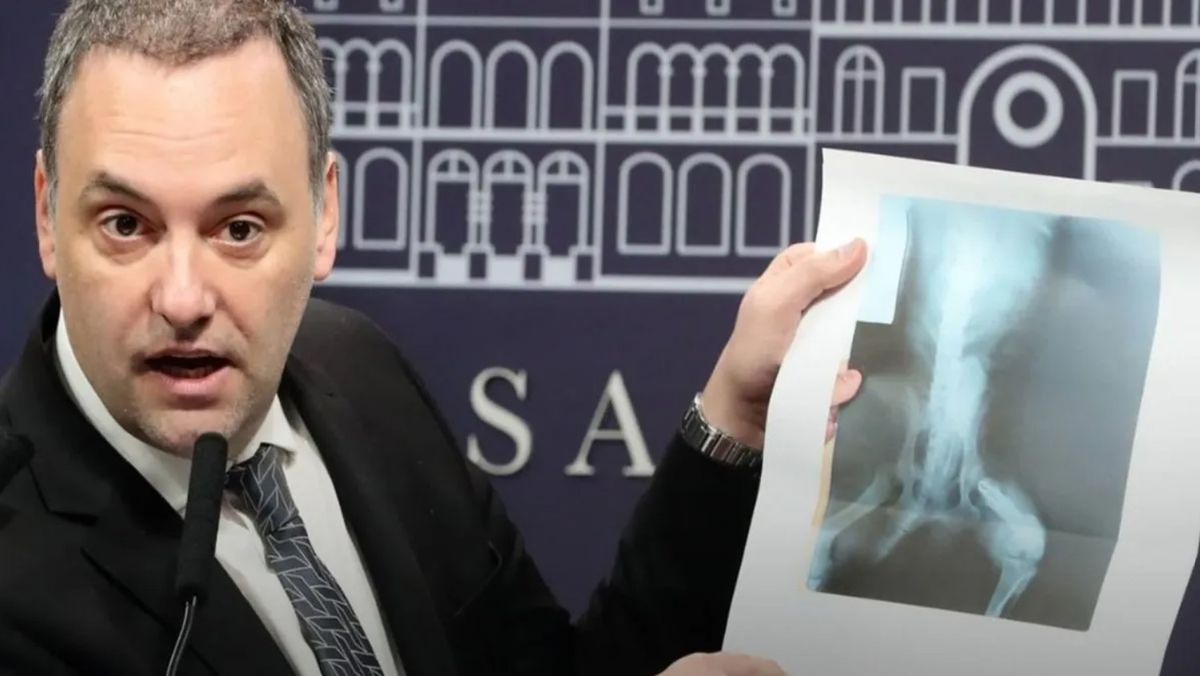 El vocero presidencial Manuel Adorni dijo que se otorgó la pensión a alguien que presentó la radiografía de un perro. El extitular de la ANDIS lo niega. El vocero presidencial Manuel Adorni dijo que se otorgó la pensión a alguien que presentó la radiografía de un perro. El extitular de la ANDIS lo niega.