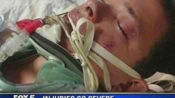 Un joven resultó herido al explotarle un cigarrillo electrónico en la boca