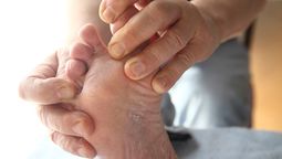 El ingrediente natural y un truco casero para sanar los hongos de los pies