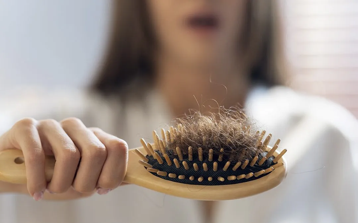 La caída del cabello es un problema que nos compete a todos por igual. Imagen: Freepik La caída del cabello es un problema que nos compete a todos por igual. Imagen: Freepik