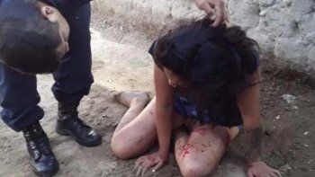 Estuvo preso por golpear a su novia, salió en libertad y la noqueó a escobazos