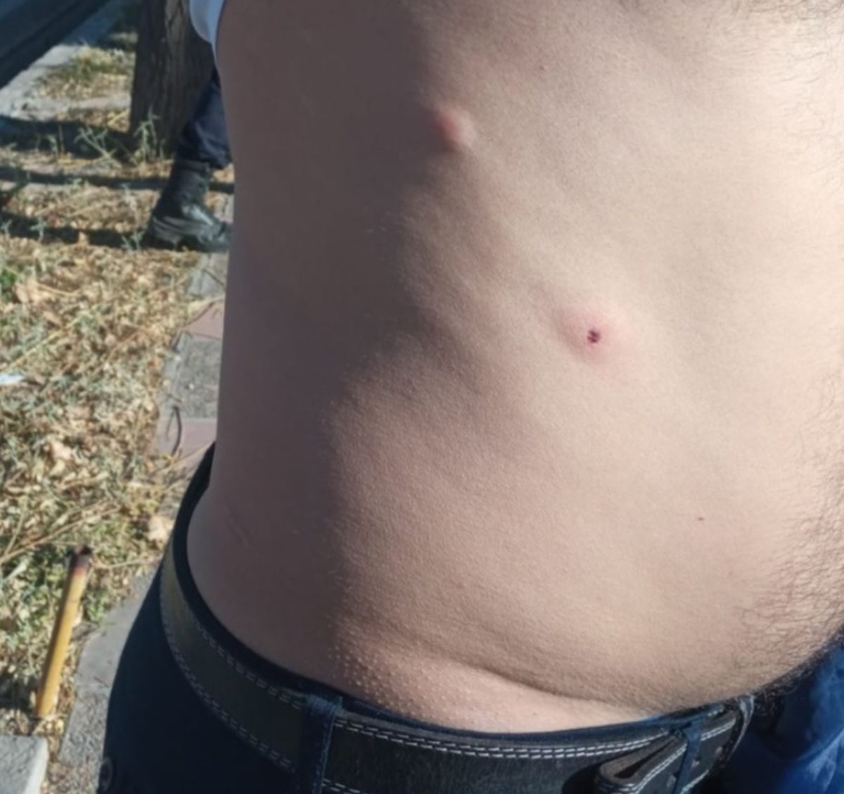El chofer del colectivo del Grupo 800 sufrió heridas en el abdomen al ser atacado por un individuo