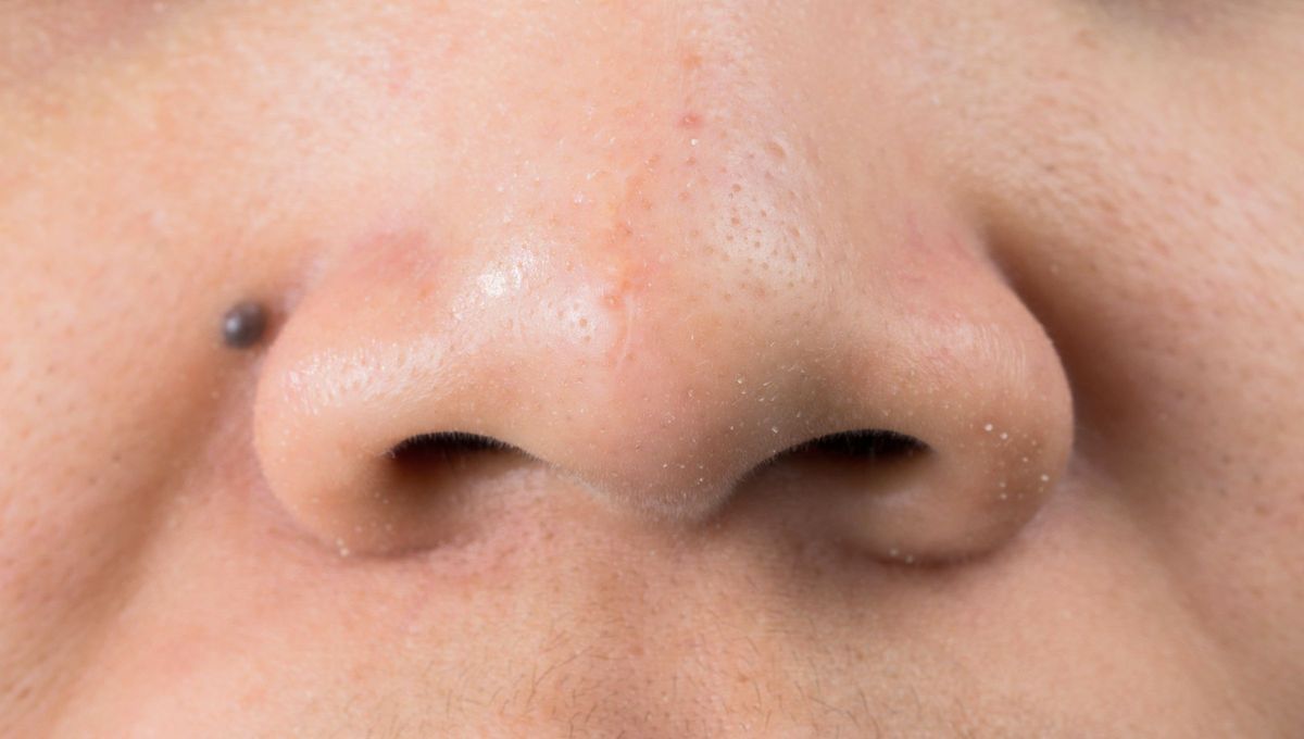 Tener lunares en la cara guarda gran informaci&oacute;n sobre vos.