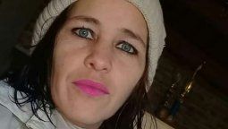 Un femicida prendió fuego la casa con su pareja adentro y tiene el 80% del cuerpo quemado