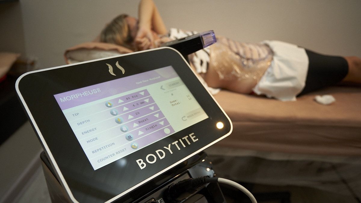 El tratamiento estético de las famosas de Hollywood está en Mendoza.