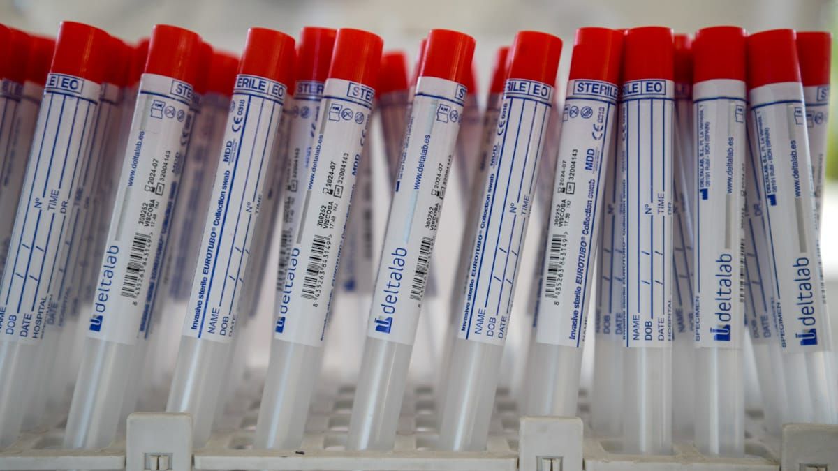 Hubo más de mil consultas en el primer día de los testeos de la Fuesmen