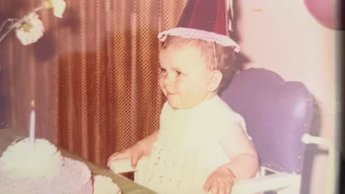 Al año de vida el pelo era incipiente y demoró ¡15 años! en crecer. Al año de vida el pelo era incipiente y demoró ¡15 años! en crecer.
