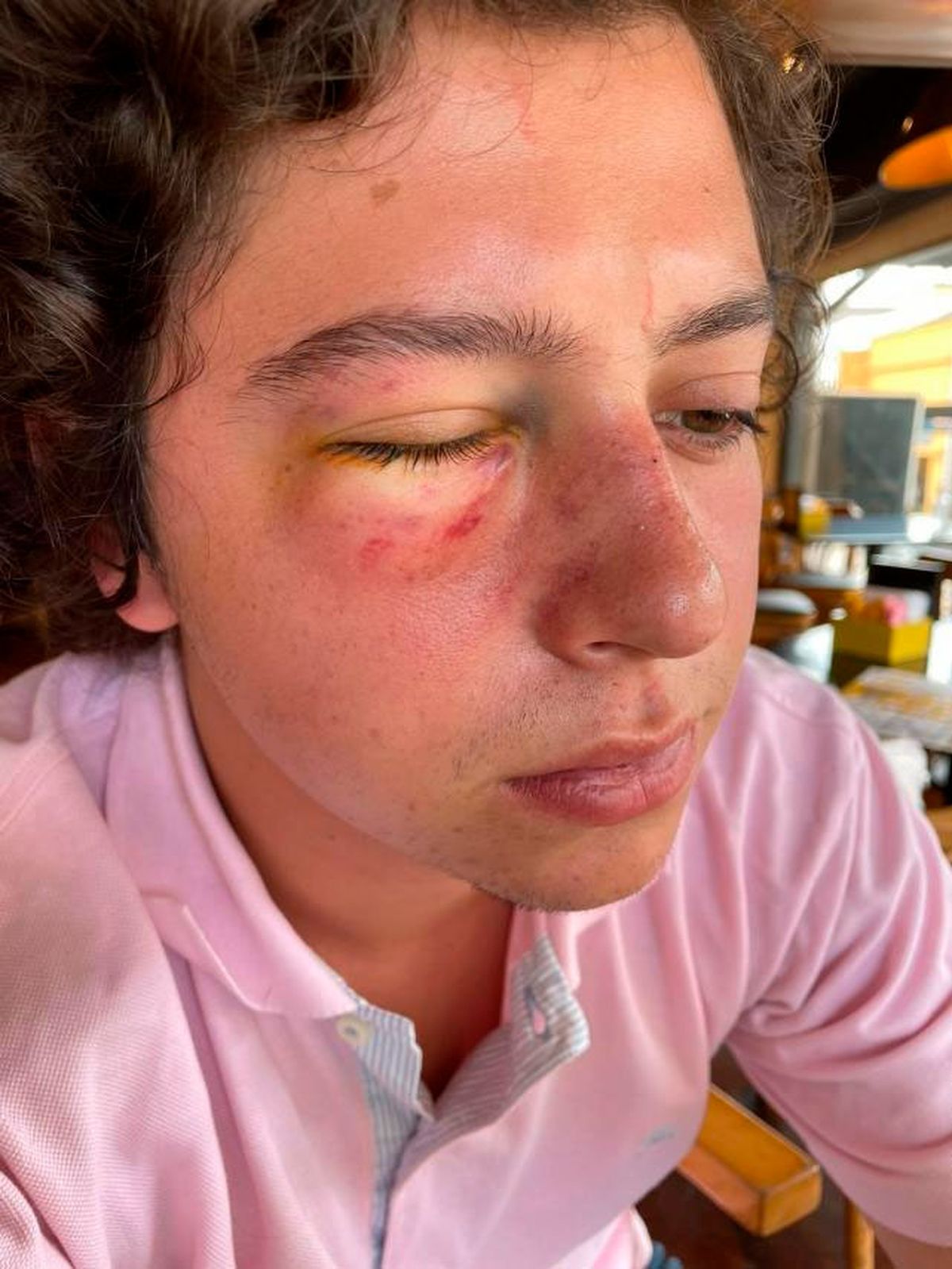 Pelea entre rugbiers: 