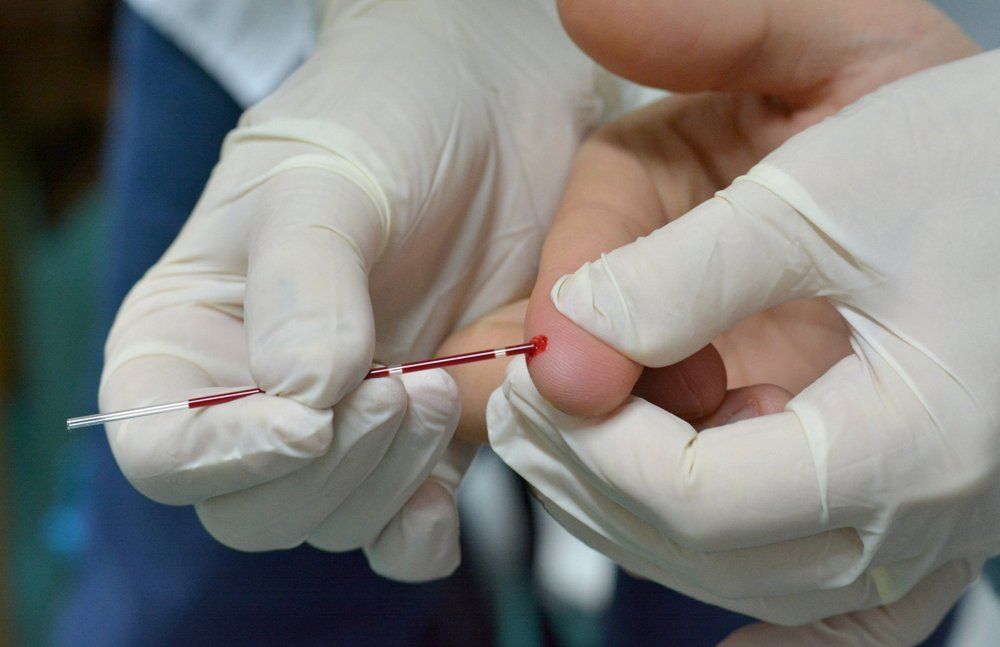 Harán test del VIH en el Hospital Universitario