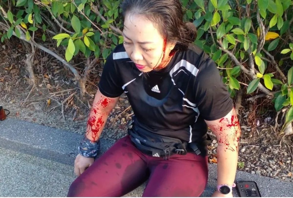 Así quedó la corredora luego del ataque de las nutrias. Así quedó la corredora luego del ataque de las nutrias.