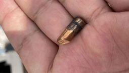 Una bala perdida impactó en la cabeza de una niña, quien pelea por su vida. Una bala perdida impactó en la cabeza de una niña, quien pelea por su vida.