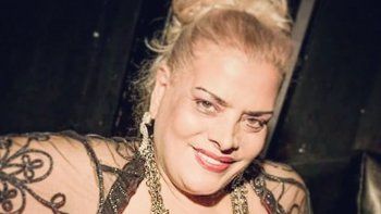 ¡Irreconocible! Lía Crucet bajó 60 kilos y pide ayuda