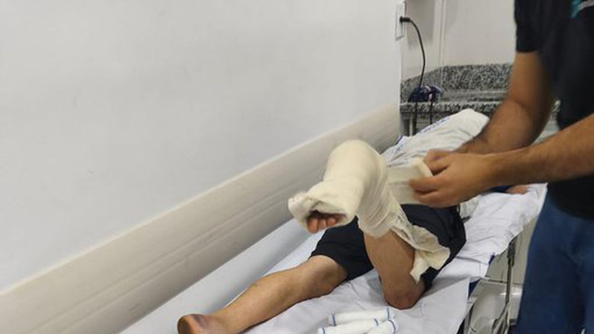 Uno de los hinchas de Godoy Cruz sufrió fuertes heridas en sus pies.