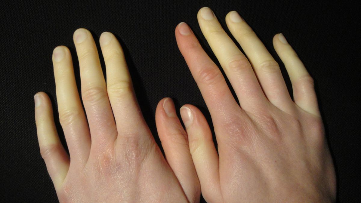 Qué significan las en las palmas de las manos