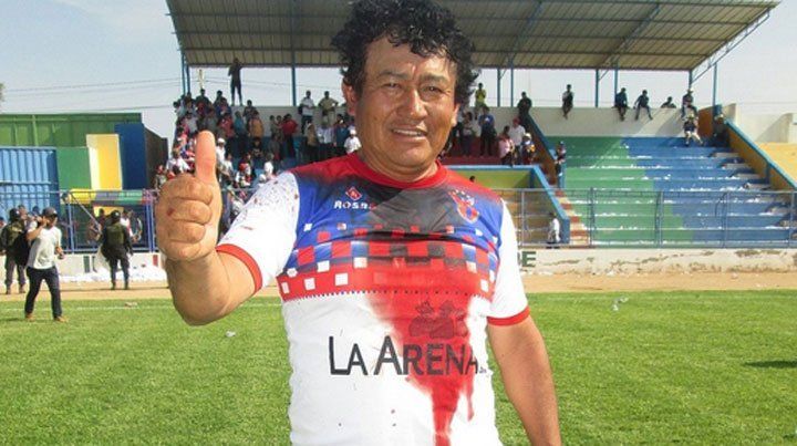 ¡Se dieron de lo lindo! Tremenda batalla sangrienta en Perú
