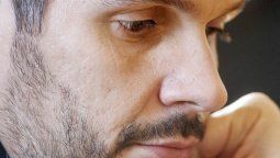 Los verdaderos ojos
