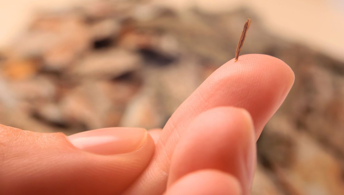 Las astillas clavadas son objetos que se incrustan debajo de la piel. En general, son peque&ntilde;os trozos de madera, pero tambi&eacute;n puede haber astillas de vidrio, metal y pl&aacute;stico.