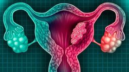 Cáncer de cuello uterino: principales recomendaciones para prevenir la enfermedad.