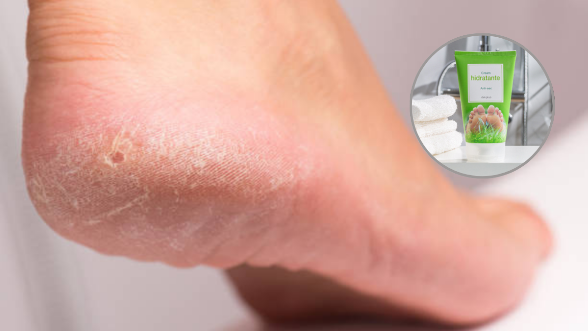 Si tus pies están resecos este producto de Mercado te brindará una hidratación intensiva.