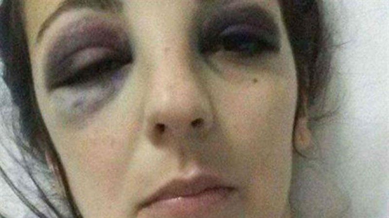 La dolorosa carta de una joven golpeada por su ex pareja: Eso no es querer. Yo sí te quise. Pero también me quiero a mí