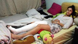 Detuvieron a un joven que le rompió la pierna a una mujer para robarle un celular