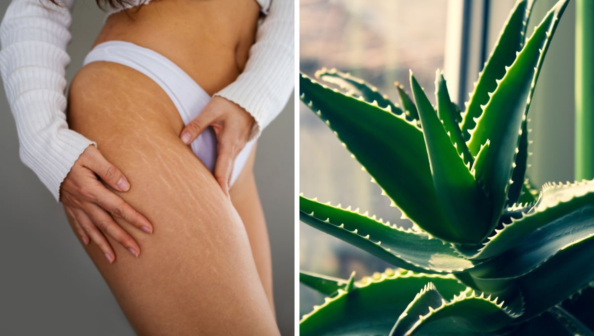 El preparado natural con aloe vera para reducir las estrías en las piernas