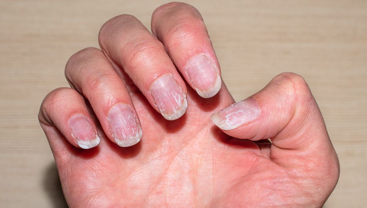 ¿Qué significa?: la ciencia explica por qué no sentimos dolor en las uñas