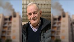 El hombre sufrió la quemadura de sus córneas y se está recuperando del incendio de su hogar.