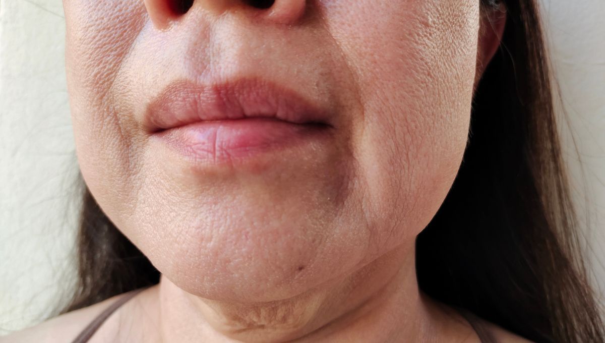 Piel arrugas. Piel arrugas.