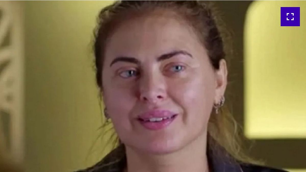 Preocupación. Silvina Luna en estado delicado: le detectaron una superbacteria.