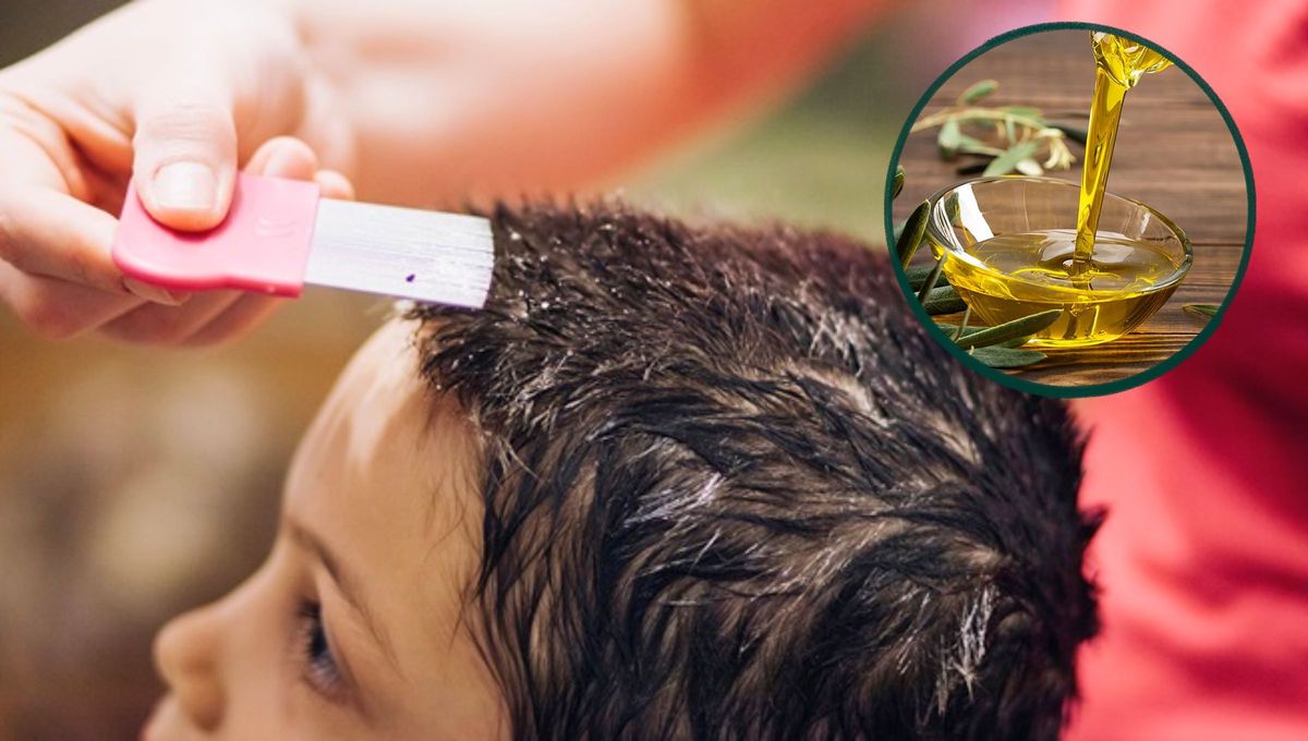 Cómo eliminar a piojos y liendres usando un poco de aceite de oliva: remedio casero efectivo