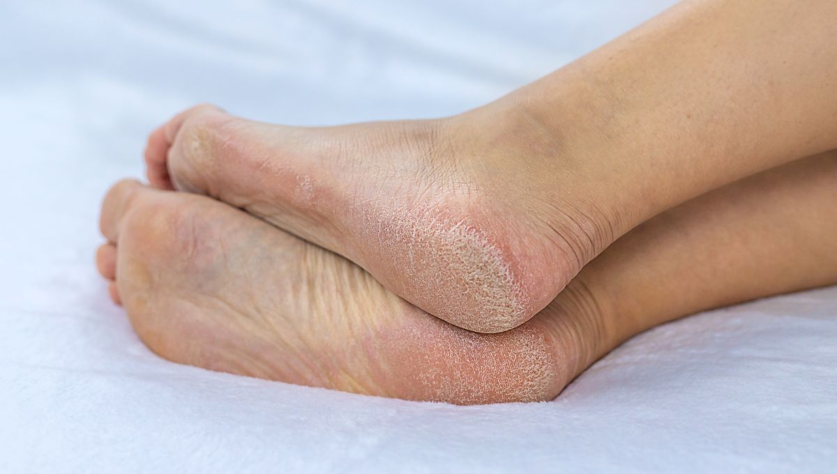 Pies secos. Pies secos.