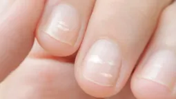 Este sencillo y económico truco casero te ayudará a eliminar las manchas blancas de tus uñas.