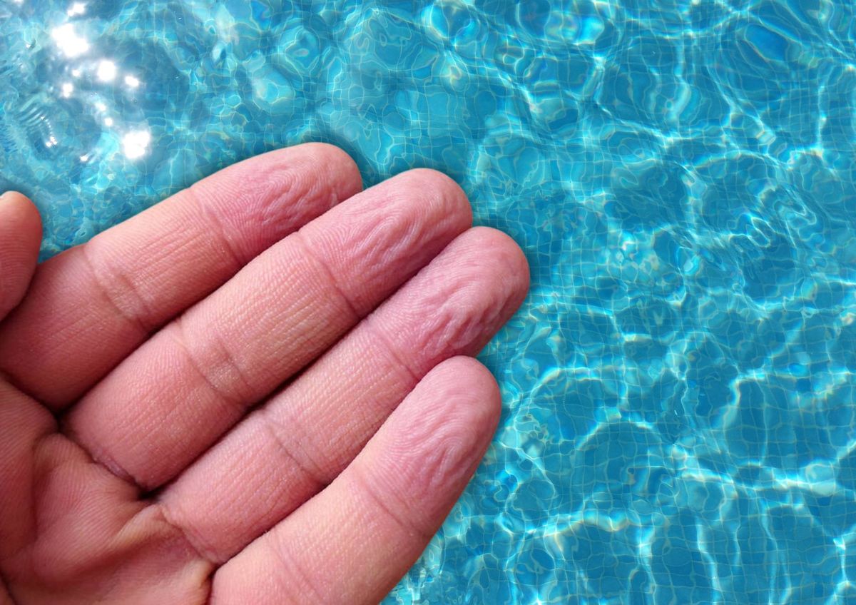 El misterio de los dedos arrugados: una respuesta protectora de la piel&nbsp;